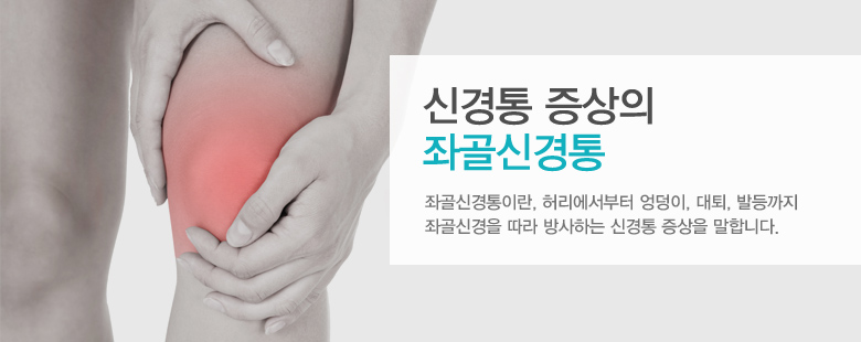 신경통 증상의 좌골신경통