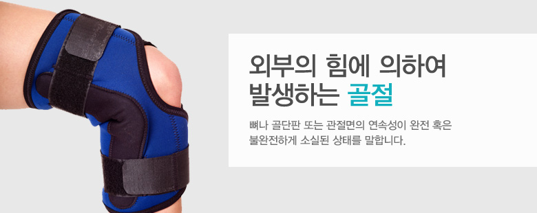 외부의 힘에 의하여 발생하는 골절