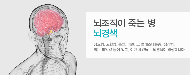 뇌조직이 죽는 병 뇌경색