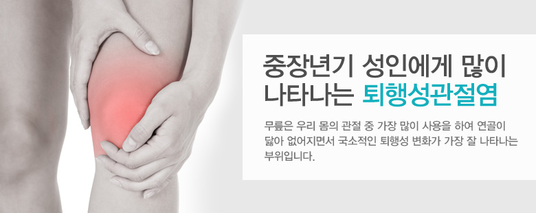 중장년기 성인에게 많이 나타나는 퇴행성관절염