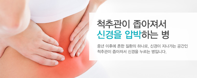 척추관이 좁아져서 신경을 압박하는 병