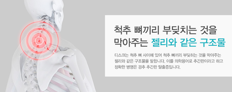 척추 뼈끼리 부딪치는 것을 막아주는 젤리와 같은 구조물