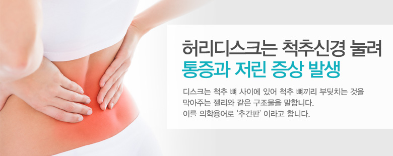 허리디스크는 척추신경 눌려 통증과 저린 증상 발생